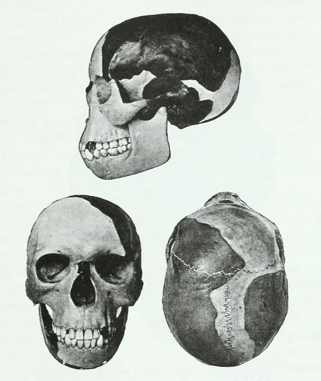 #16 The Piltdown Man: The Famous Fraud That Made Everyone More Careful (Calvin Suverill Case, A practical treatise on the technics and principles of dental orthopedia and prosthetic correction of cleft palate, Published 1921, Public domain)
