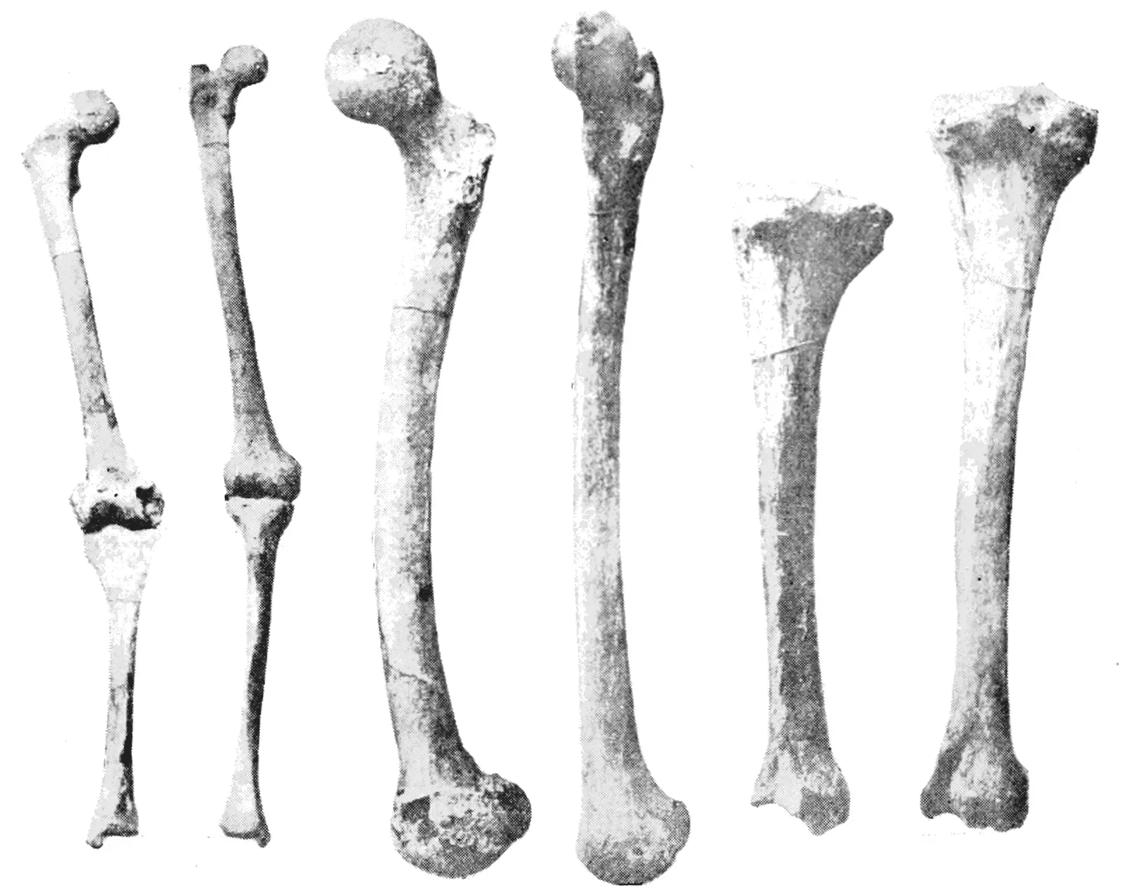 #11 - The Leg Bones Grow Denser Exactly Where It Counts (Popular Science Monthly Volume 44, Public domain)