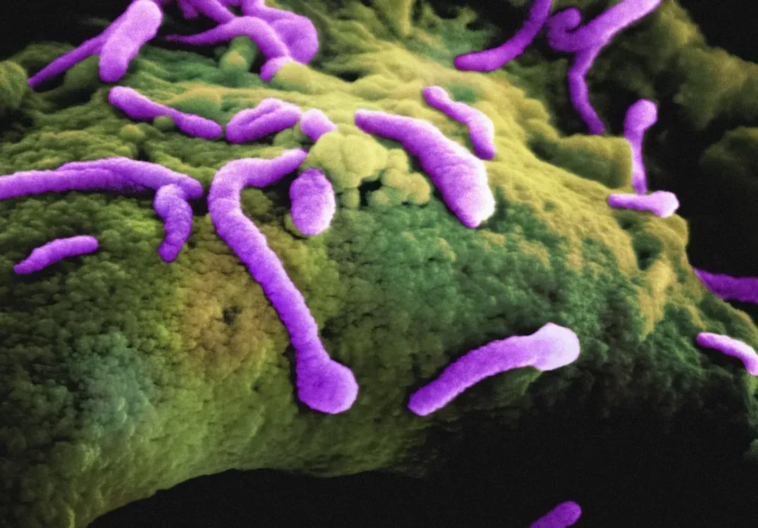 Deep Subsurface Biosphere: A Hidden World Beneath Our Feet (Image Credits: Unsplash)