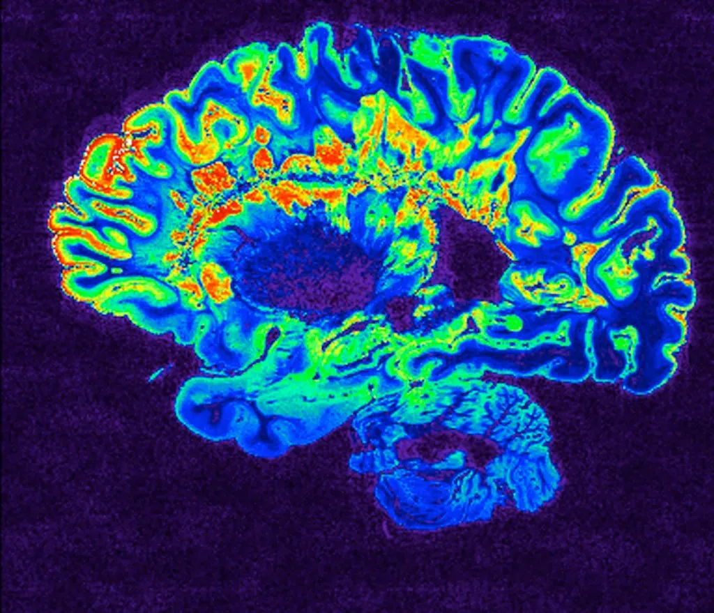 Brains, Hemispheres, and Hallucinated Commands (Image Credits: Flickr)