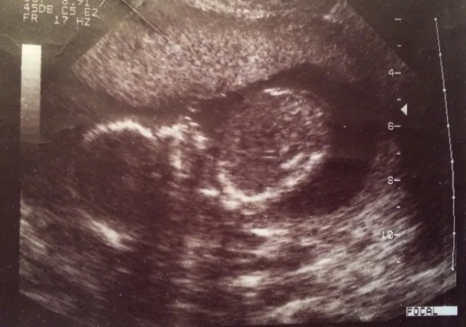 Your Memories Actually Begin Before You Are Born (tmoo1, Flickr, CC BY 2.0)