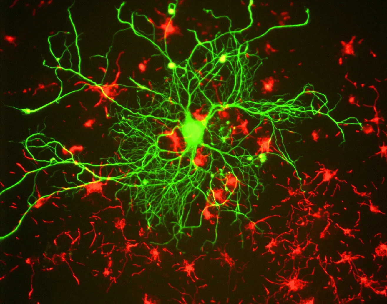 Loss of Stem Cell Function: The Drying Well of Regeneration (By GerryShaw, CC BY-SA 3.0)