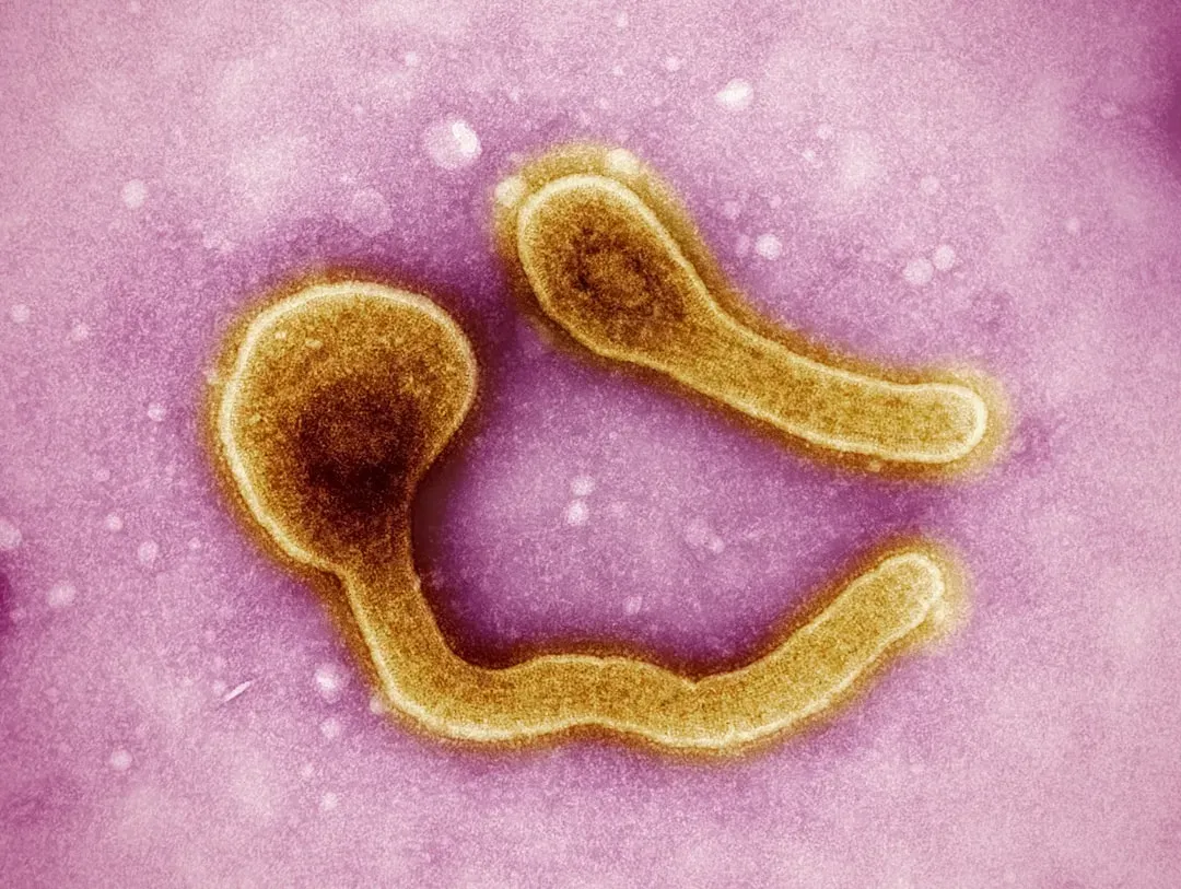 The Cholera Misconception: How Bad Germ Theory Delayed Life-Saving Change (Image Credits: Unsplash)