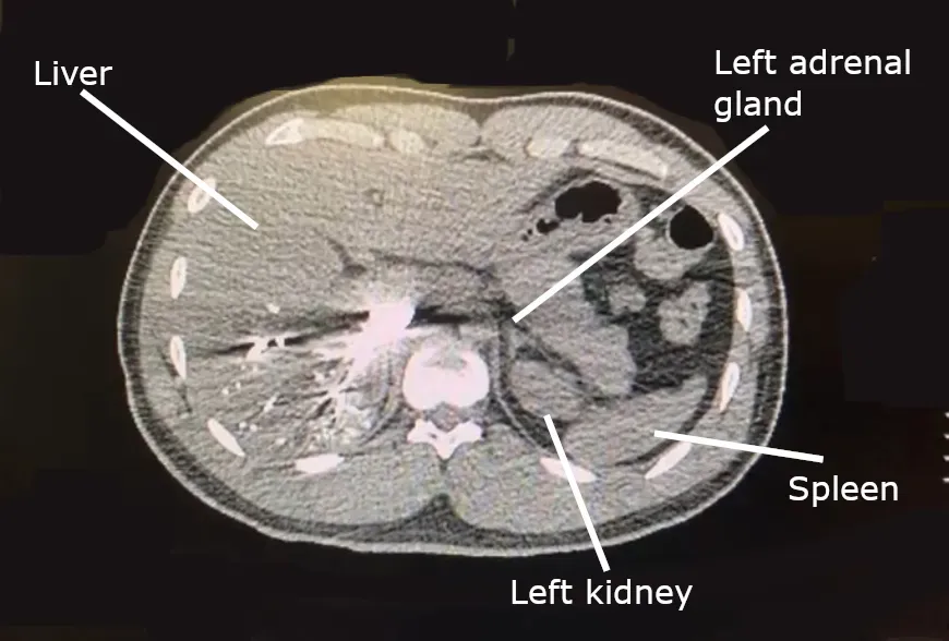 Near-Death Experiences: Strange Stories, New Data (By Cerevisae, CC BY-SA 4.0)