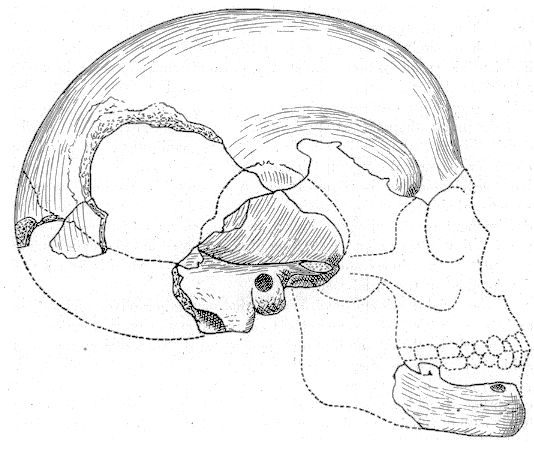Boskop Man (Homo capensis): The Big-Brained Mystery (Image Credits: Wikimedia)