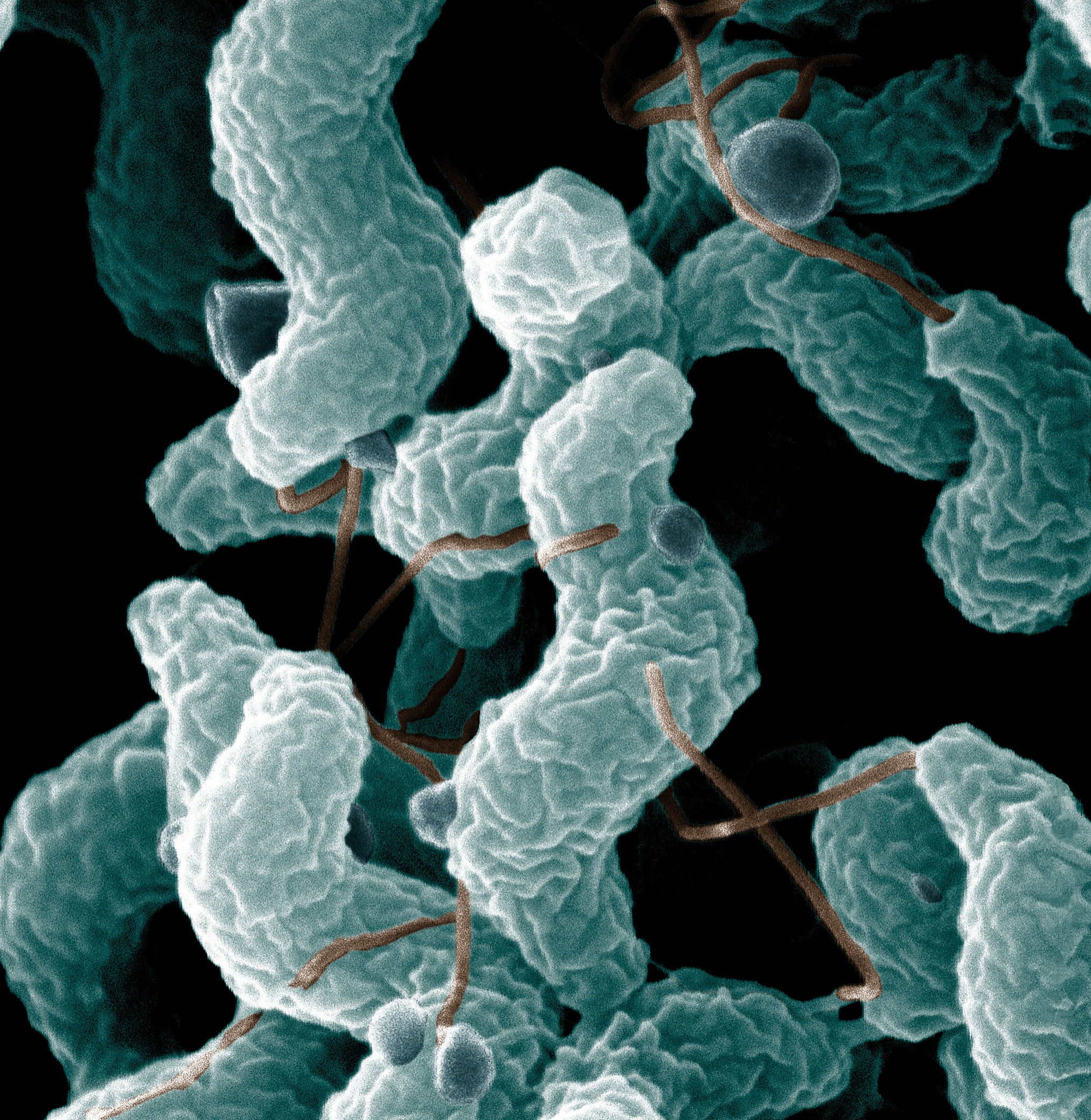 Why It Matters (Image Credits: Wikimedia)