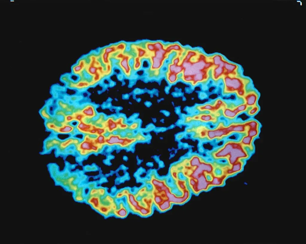 Energy, Metabolism, and the Brain’s Need to Power Down (Image Credits: Flickr)