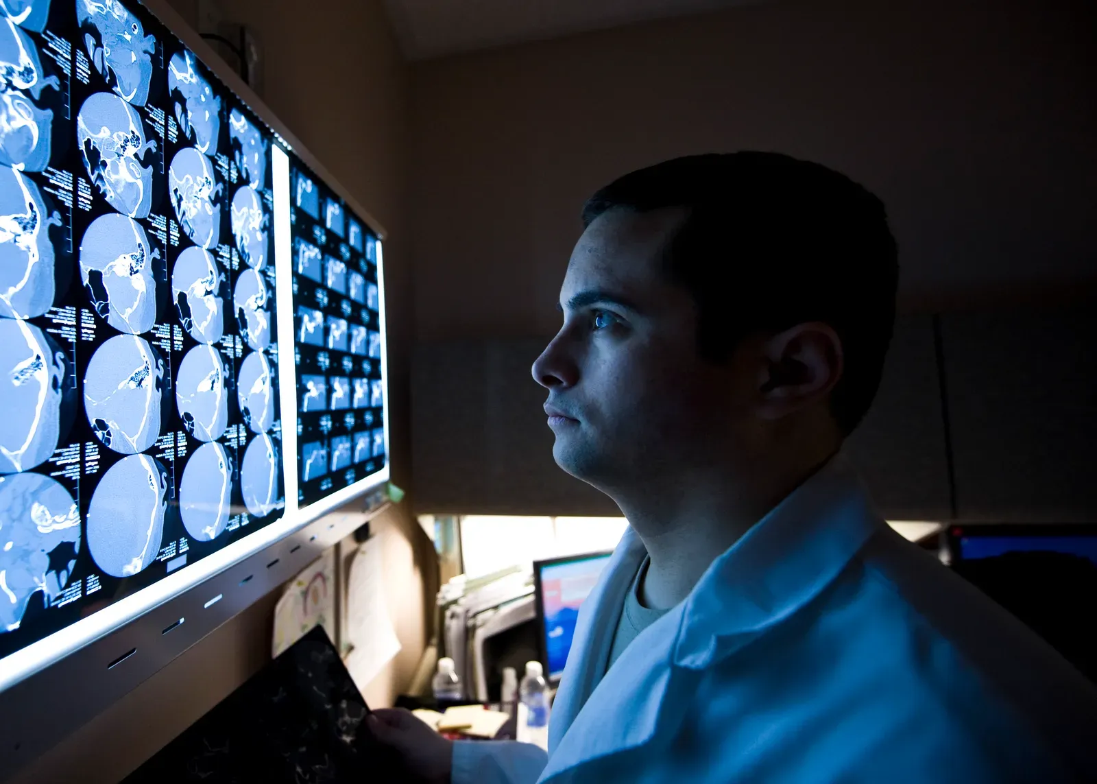 Clinical Clues: When Thoughts Survive But Consciousness Fades (Brain scan, Public domain)