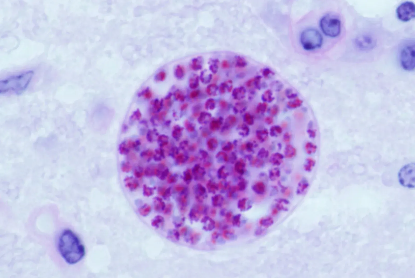 The Toxoplasma Parasite: A Brain-Hijacking Microbe Among Us (Image Credits: Wikimedia)