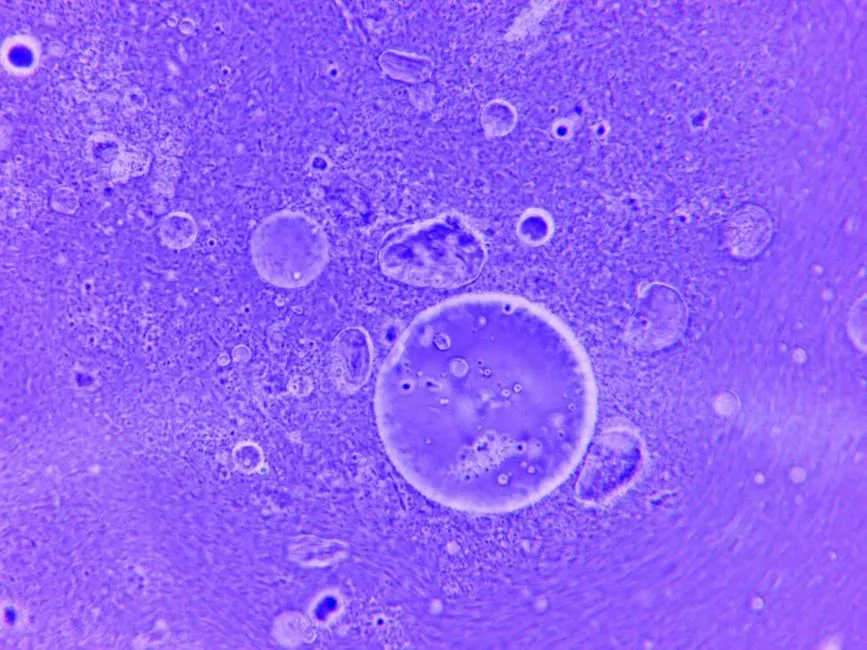 Senolytics: Clearing Out Your “Zombie” Cells (Image Credits: Pexels)