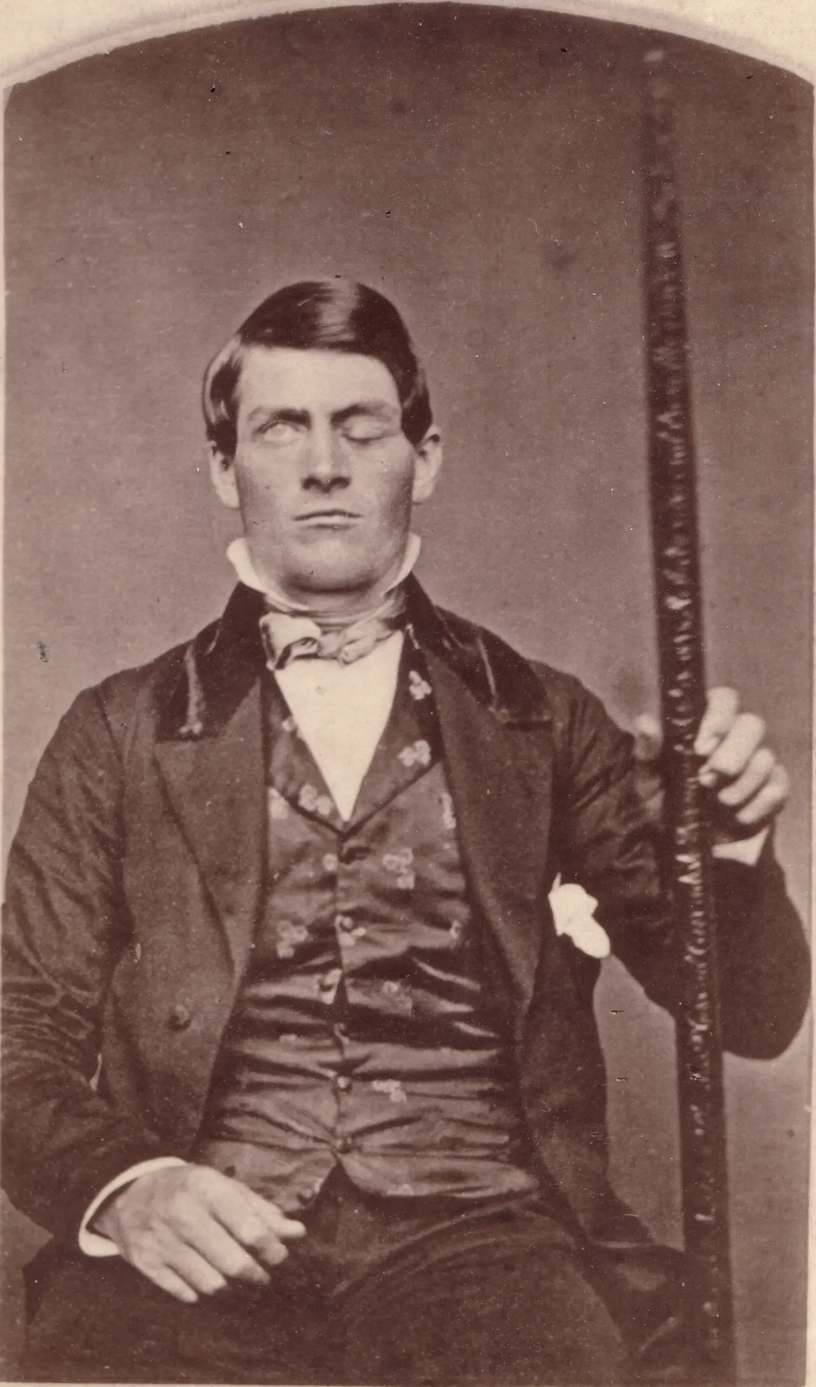 Phineas Gage: The Man with the Iron Will (Image Credits: Wikimedia)