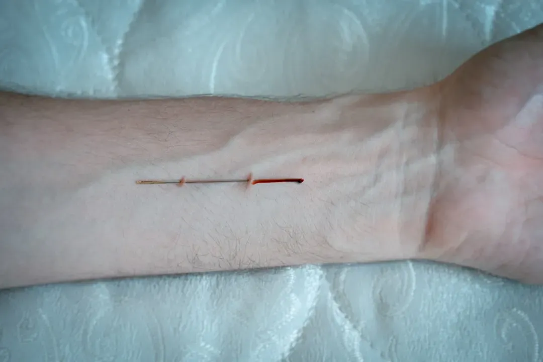 #13 - The Bullet That Found the Same Scar Twice (Image Credits: Unsplash)