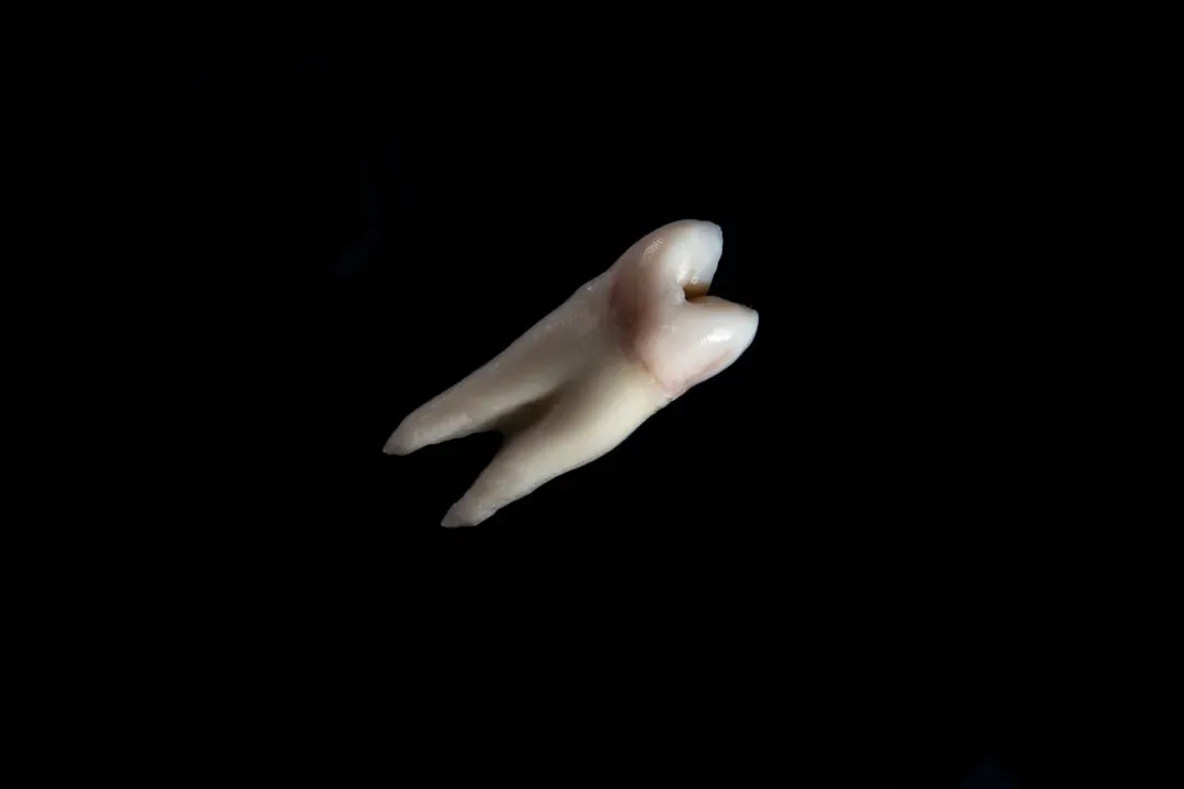 #8 - Your Diet Gets Permanently Stamped Into Your Teeth (Image Credits: Unsplash)