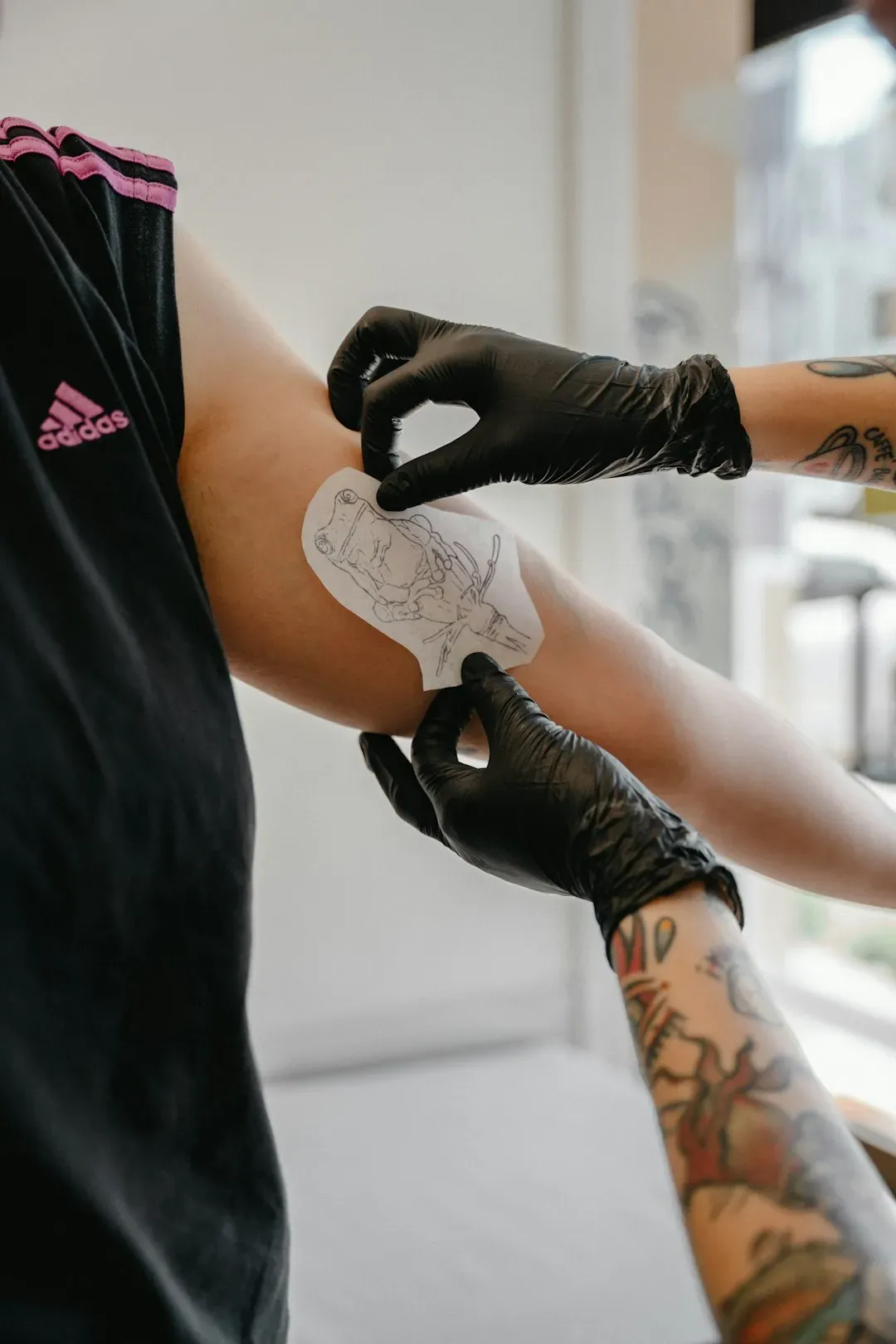 5. Painless Nanoneedle Diagnostics: The Biopsy Gets a Radical Makeover (Image Credits: Unsplash)