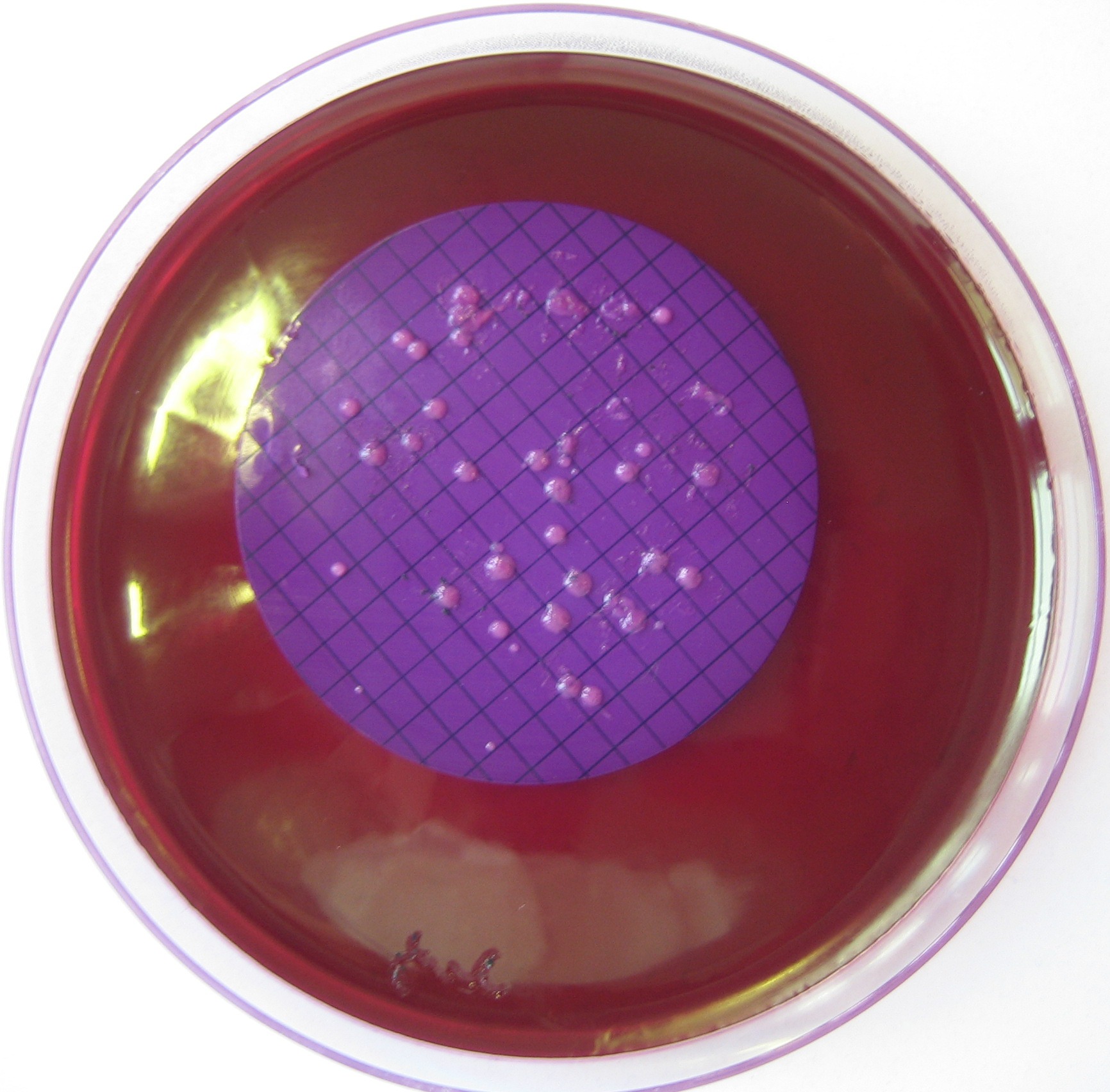 The Slow Dance of Microbial Revival (Image Credits: Wikimedia)