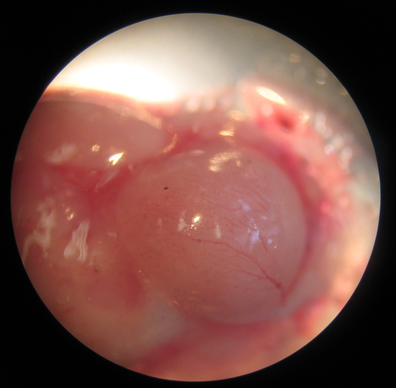 The Future Landscape: Precision, Sensors, and New Therapies (Image Credits: Wikimedia)