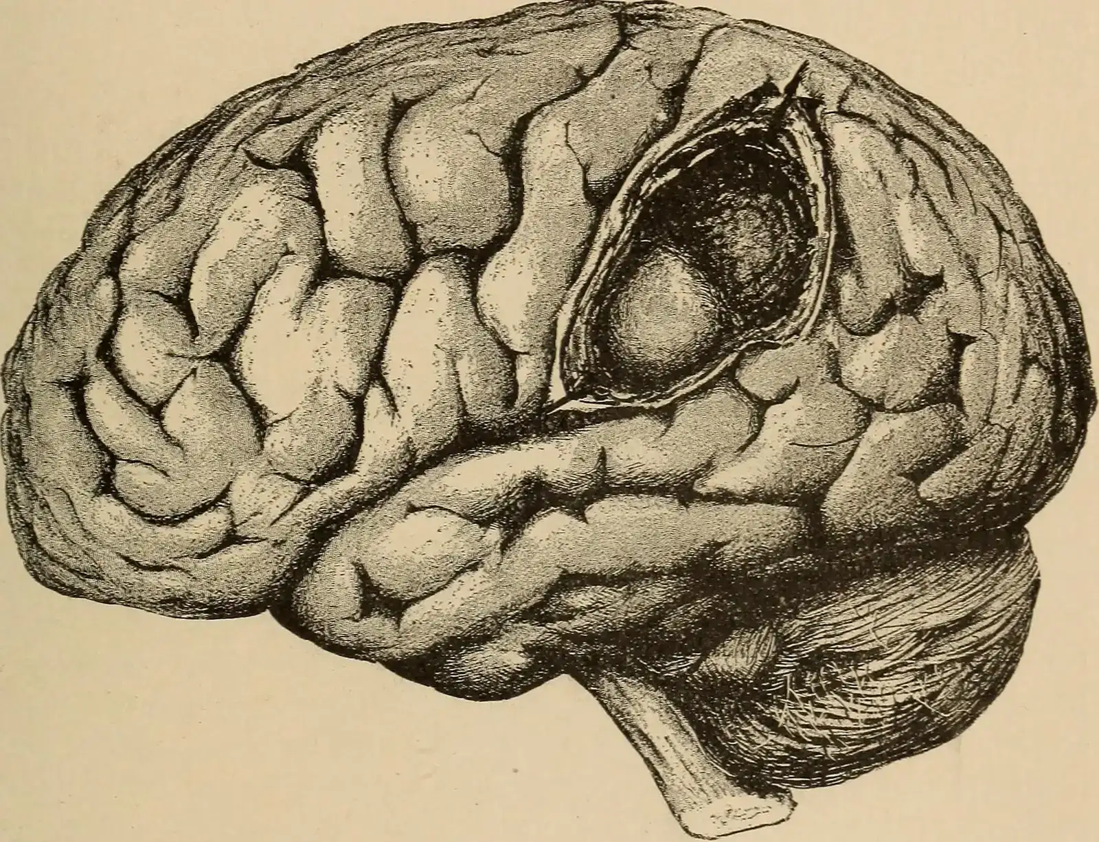 Predictive Brains and Controlled Hallucinations (Image Credits: Wikimedia)