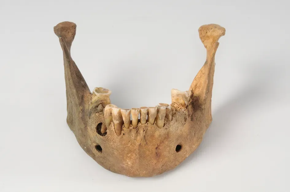 #4 - Worn-Down Teeth Expose Someone's Job (Object from the exhibition We call them Vikings produced by The Swedish History Museum, CC BY 2.0)