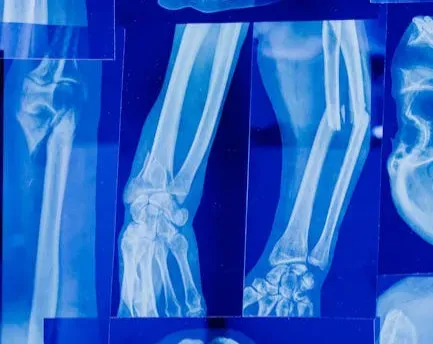 Your Bones Are Constantly Broken Down and Built Back Stronger (Image Credits: Pexels)