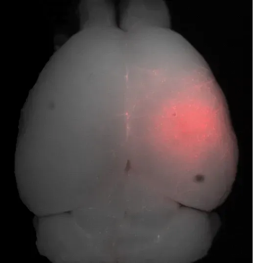 Edge-of-Life Mysteries: Near-Death Experiences and the Dying Brain (Image Credits: Wikimedia)