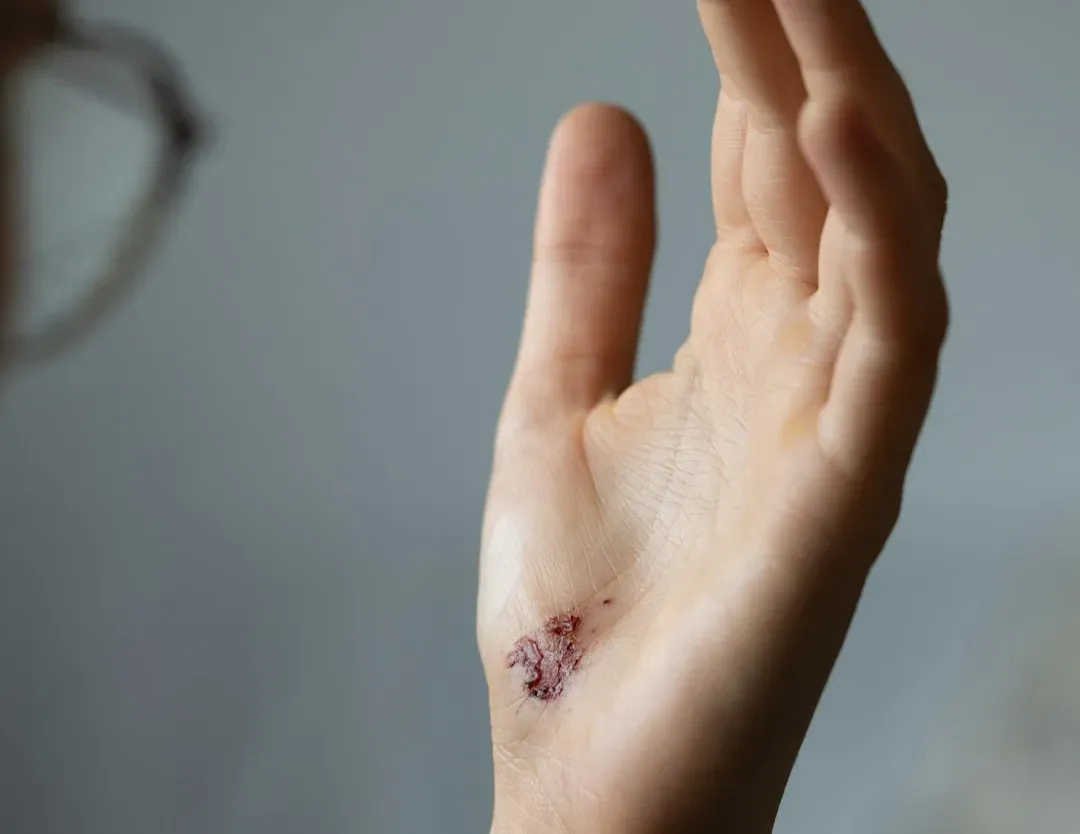 Scars, Clots, and New Skin: How Wound Healing Is Smarter Than It Looks (Image Credits: Unsplash)
