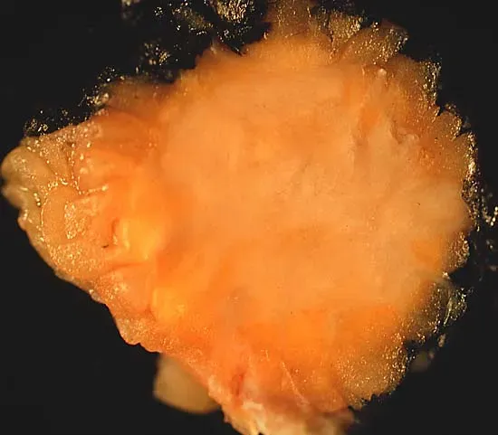 Senolytics: The Drugs That Target Zombie Cells (Image Credits: Wikimedia)