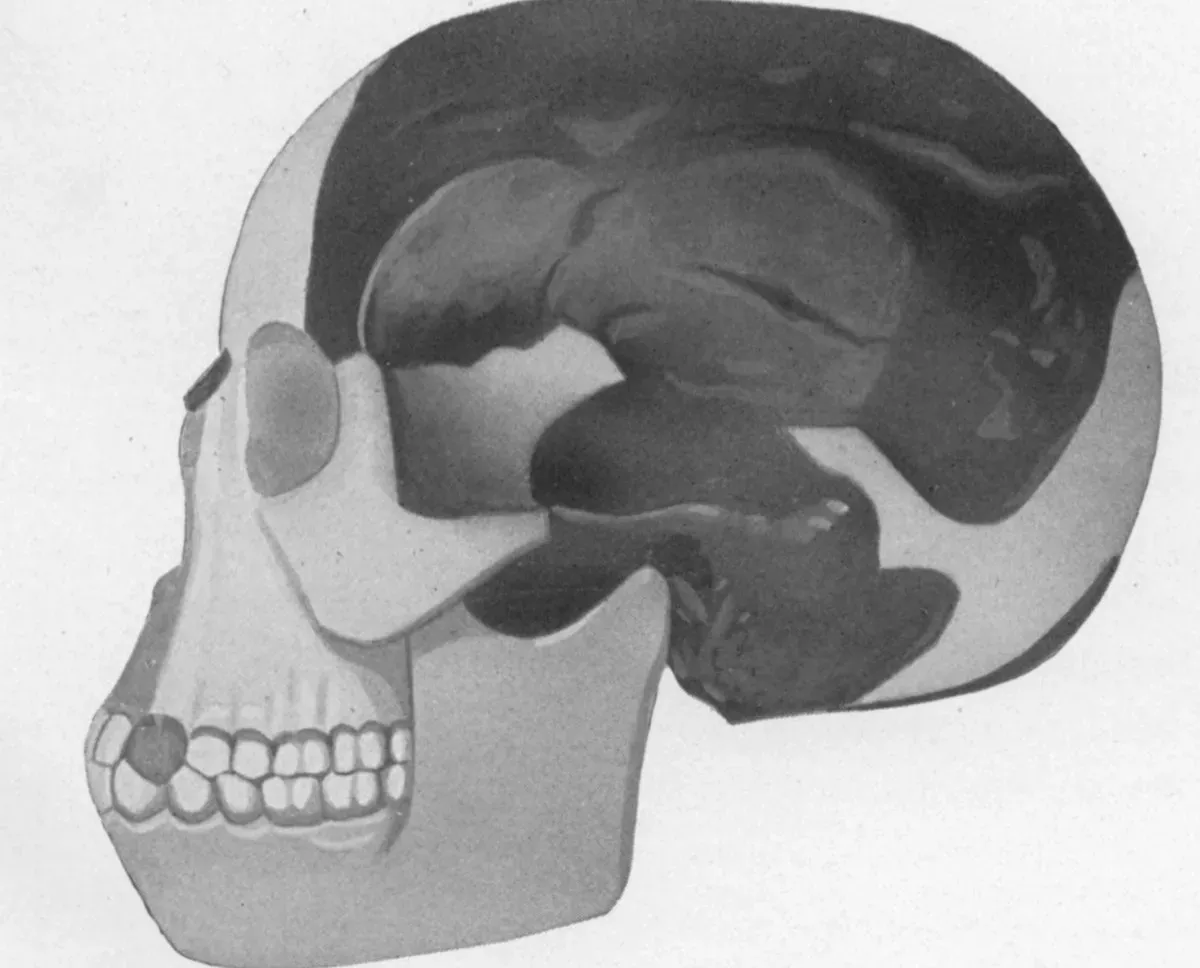 The Piltdown Man: The Fossil That Never Was (Image Credits: Wikimedia)