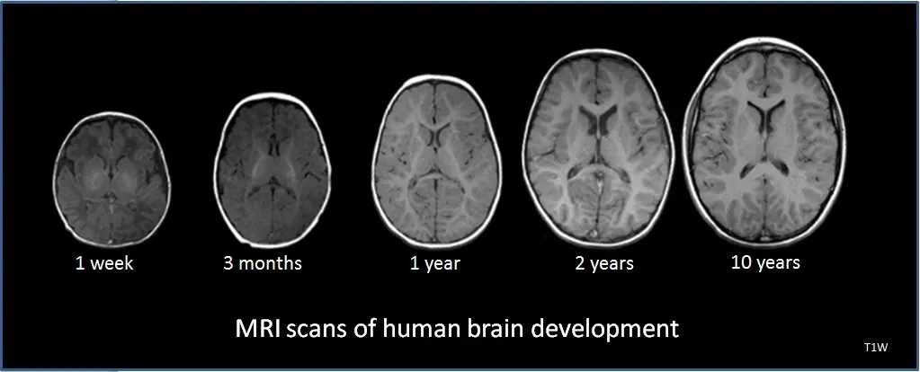 10. Your Brain's Development Continues Well Into Adulthood (By National Institutes of Health, Public domain)