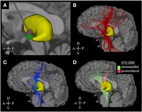 The Future Landscape: Brain Preservation, Simulation, and Digital Ghosts (Image Credits: Wikimedia)