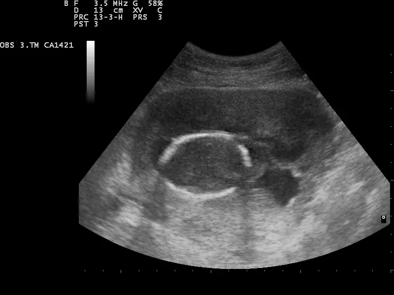 New Tools Offer Hope for Breakthroughs (Image Credits: Wikimedia)