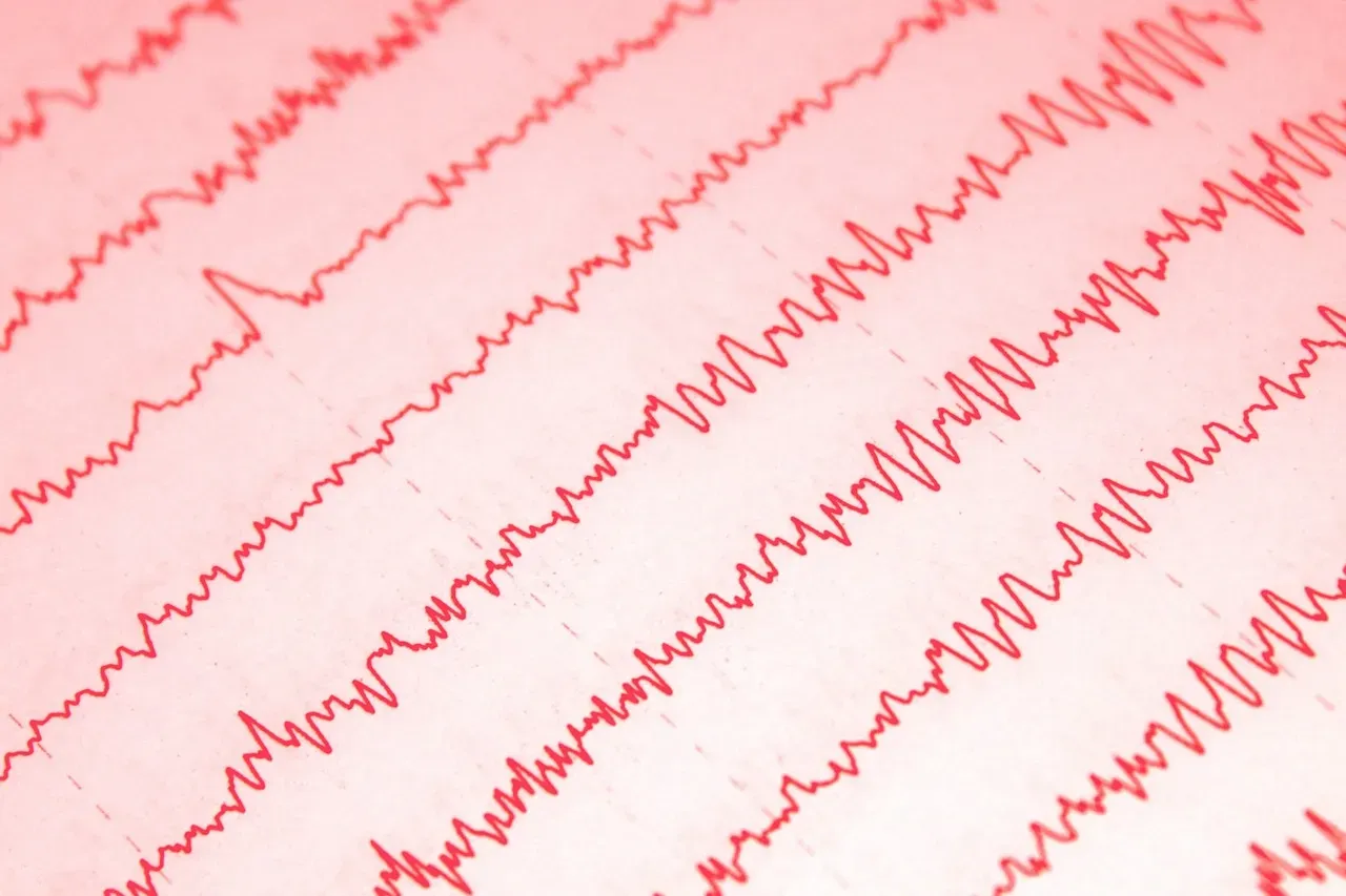 From Flat Line To “Last Network Spike”: What Multichannel Recordings Show (Image Credits: Pixabay)