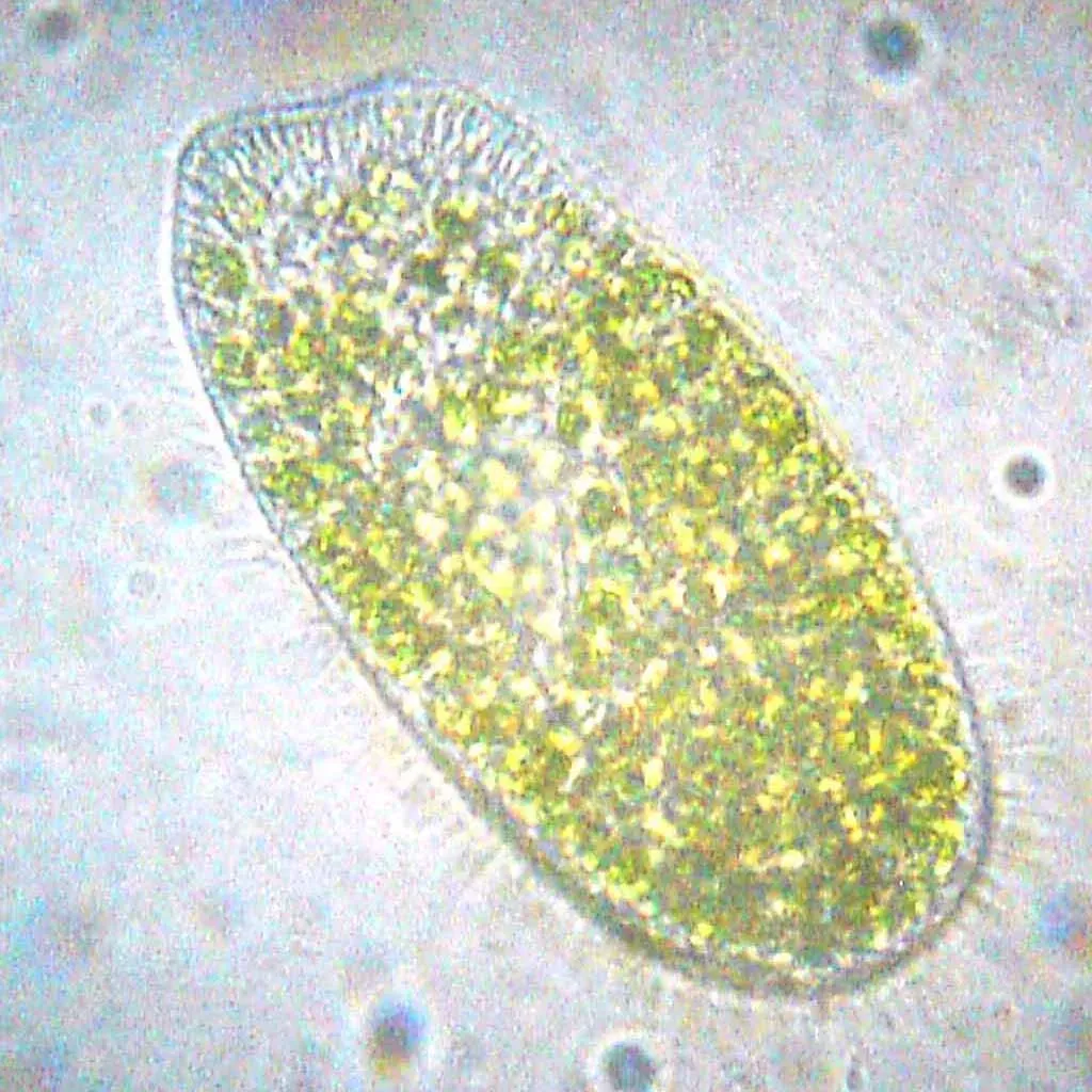 Microscopic Hunters Swimming in Pond Water (Image Credits: Wikimedia)