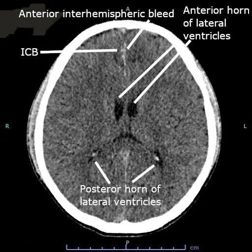 The Physics of Thought: Signals, Not Souls (Image Credits: Wikimedia)