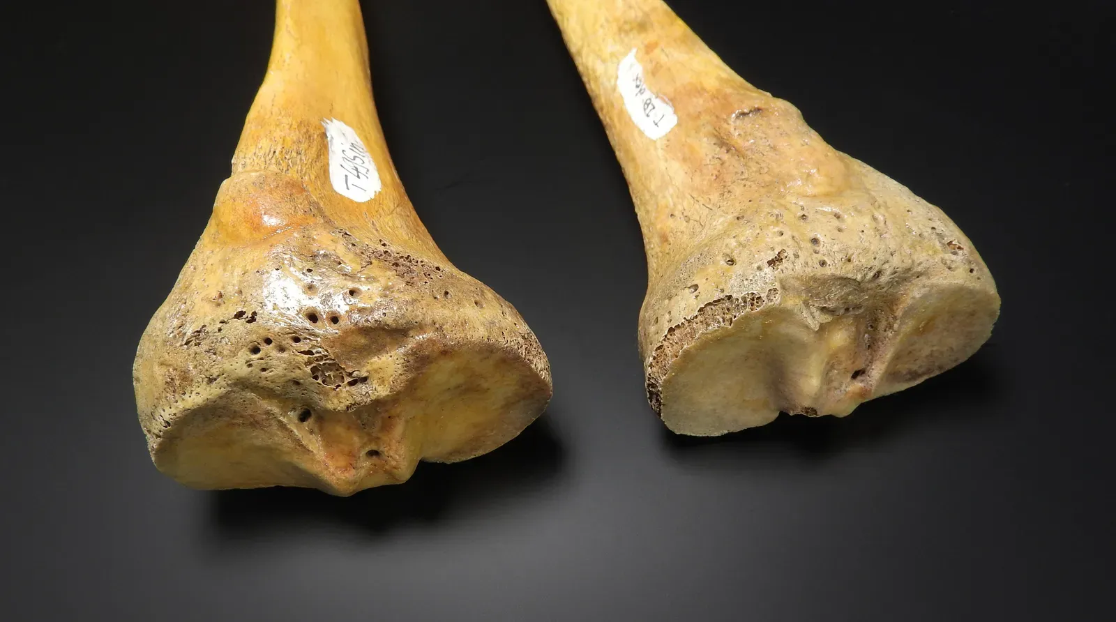 #3 - The Tibia Is Flattened Side-to-Side (Platycnemia) (By MAKY.OREL, CC0)