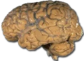 2. The Brain Isn't Built From Neat "Modules" (By National Institutes of Health, Public domain)