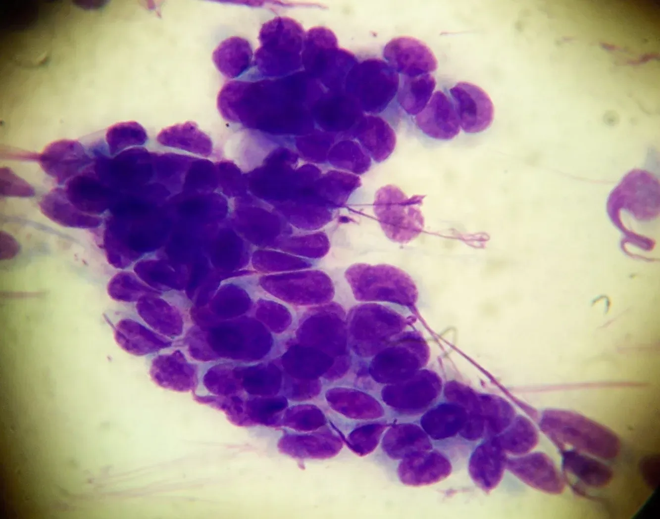 Oxygen Cutoff and the First Waves of Cellular Panic (By Carcarrot, CC BY-SA 4.0)