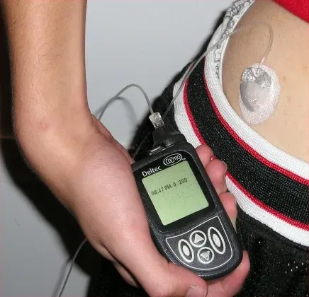 3. Artificial Pancreas Systems Free Diabetes Patients from Constant Monitoring (Image Credits: Wikimedia)