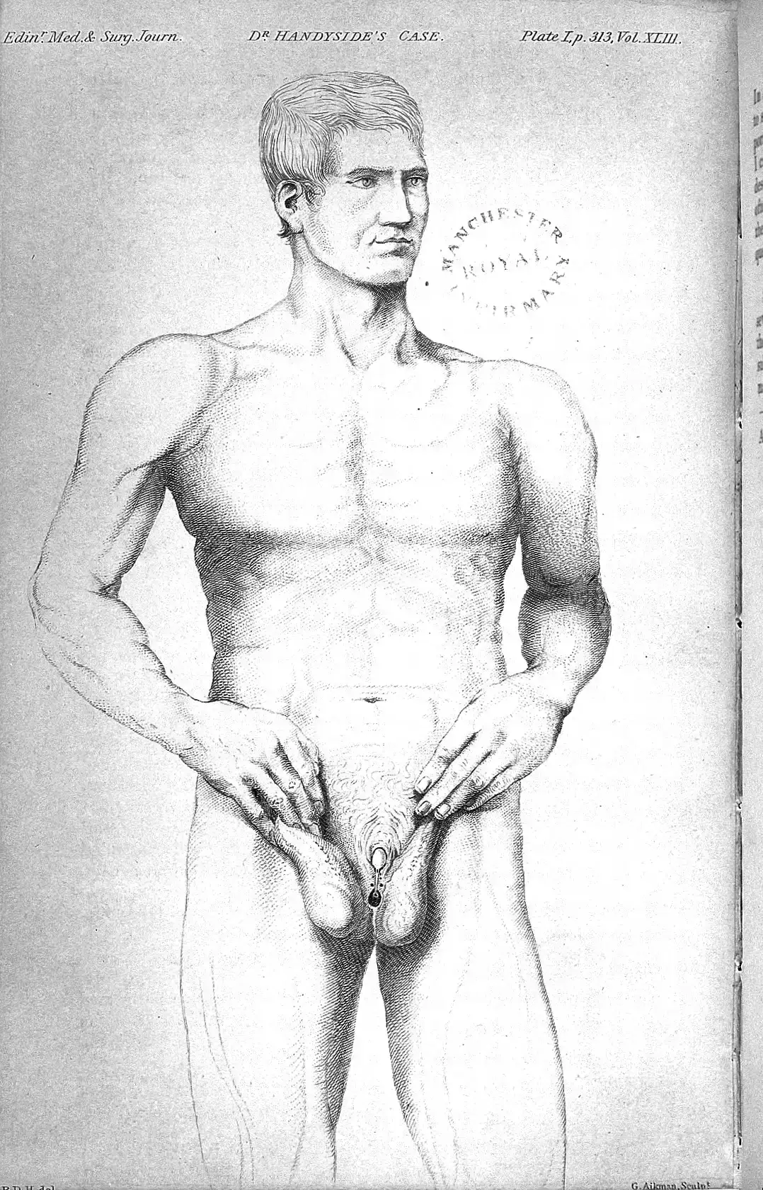 Living With a Body That Breaks the Mold (Image Credits: Wikimedia)