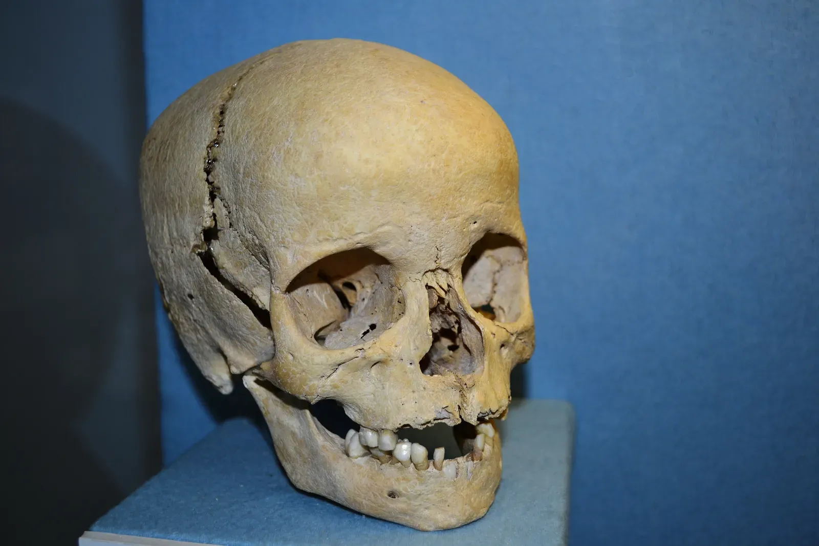 #3 - Skull Sutures Are a Built-In Age Clock (By High Contrast, CC BY 3.0 de)