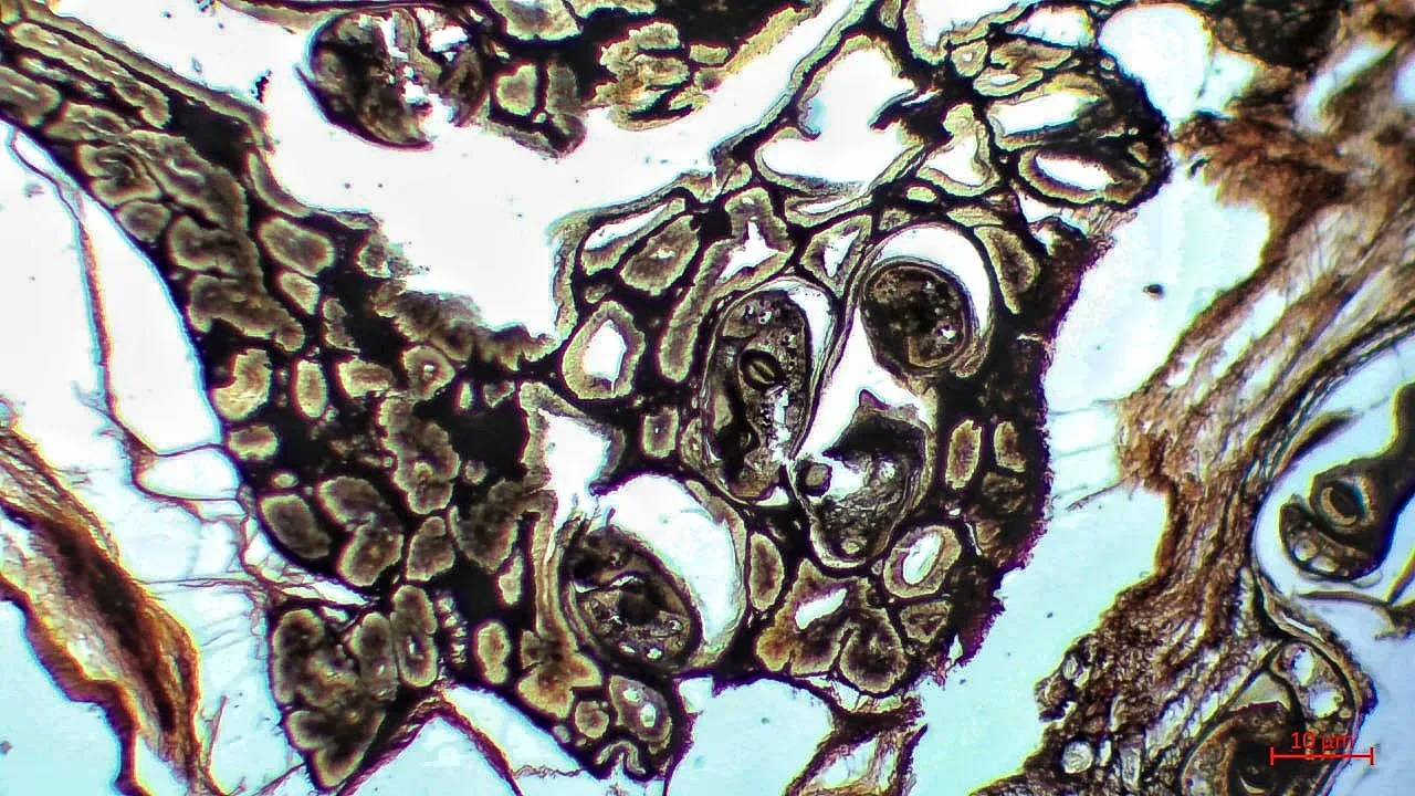 #3 - Polar Nematodes Nobody Bothered to Describe (By Chrystyna Martyniuk,Yana Kovalova, Dmytro Marchuk, CC BY-SA 4.0)