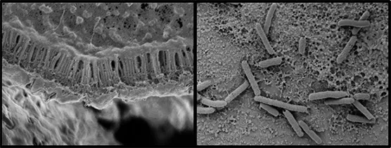 2. Faecalibacterium Prausnitzii: Your Body's Quiet Anti-Inflammatory Powerhouse (Flickr, Public domain)