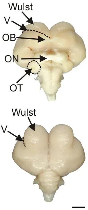The Future Landscape: Decoding Conscious Vision (Image Credits: Wikimedia)