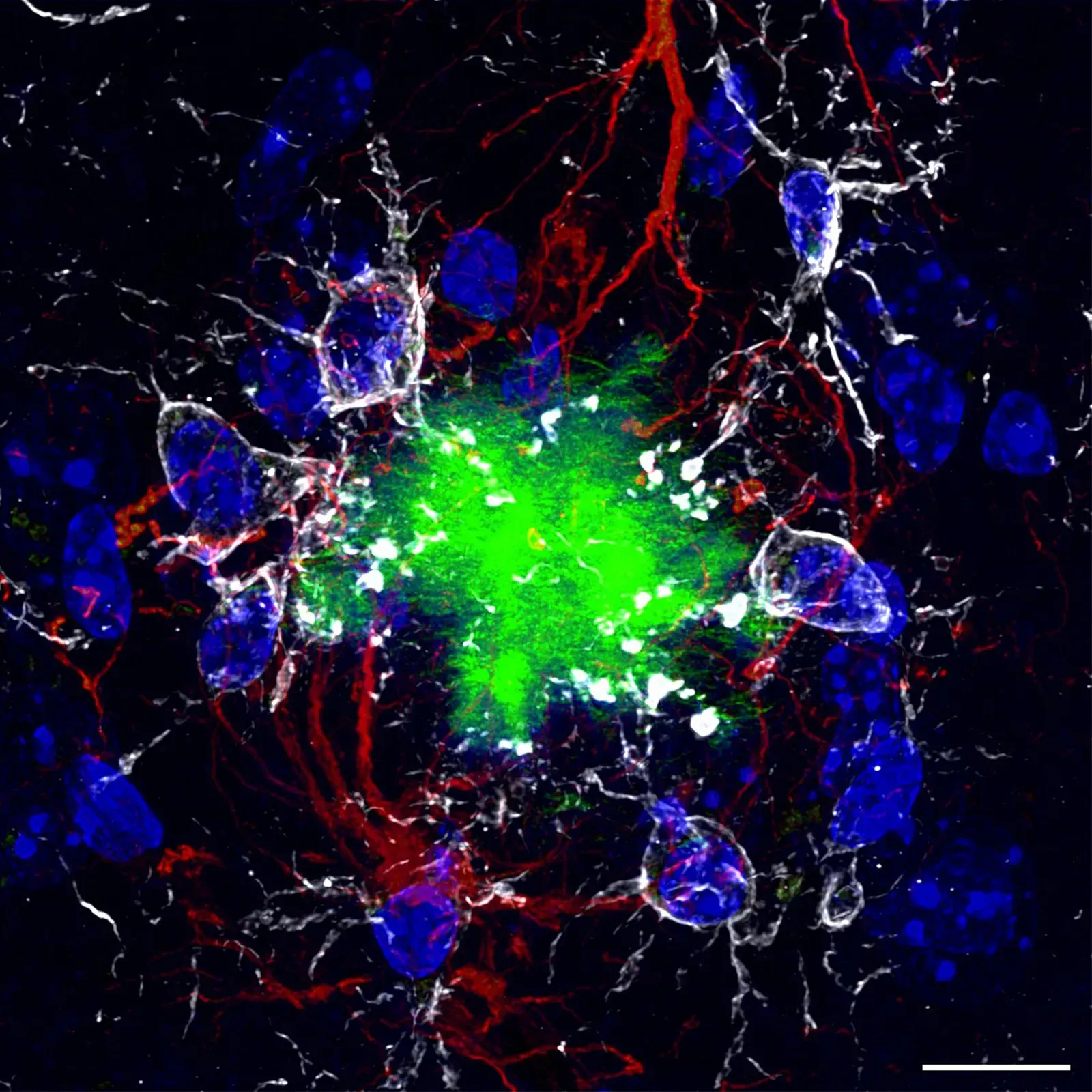 Hidden Costs: Glia, Maintenance, and Housekeeping (By Nicocapelo, CC BY-SA 4.0)