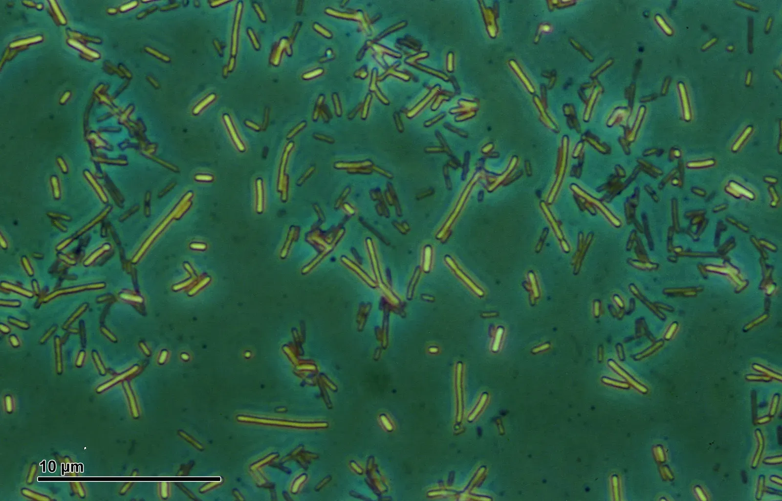 #12: Microbes Known Only From Gut DNA (Author's archive, CC BY-SA 3.0)
