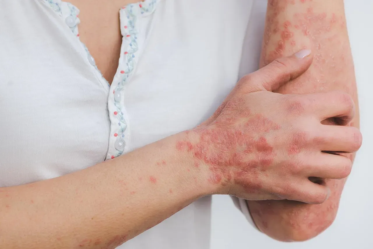 Your circulation slows, and your skin tells the story (Image Credits: Pixabay)