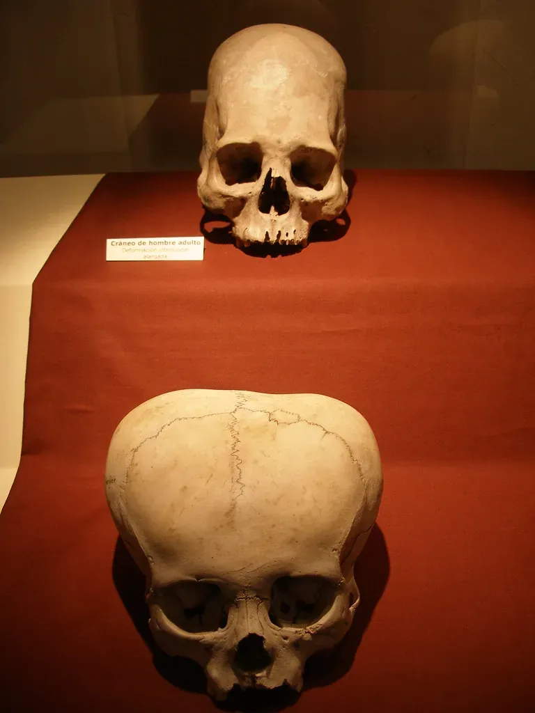#10 - Rare Anatomical Quirks Can Almost Fingerprint a Skull on Their Own (quinet, Flickr, CC BY 2.0)