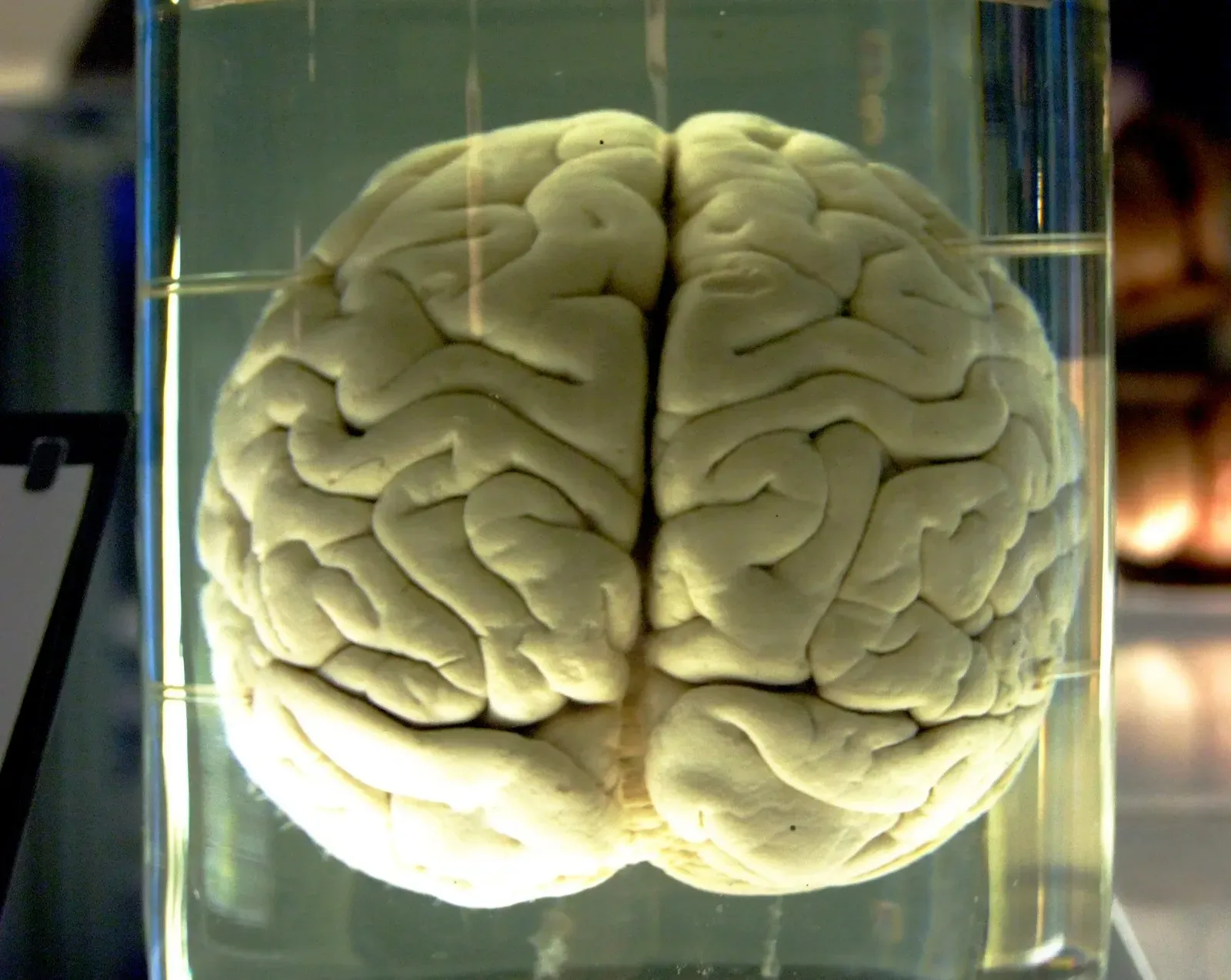 Limits, Unknowns, and Why This Still Matters (Image Credits: Wikimedia)