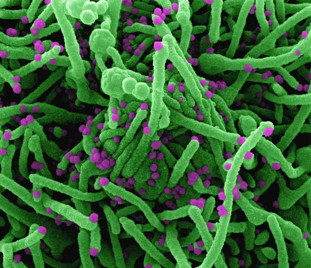 #15 Ulcers Are Caused by Bacteria, Not Just Stress (Image Credits: Unsplash)