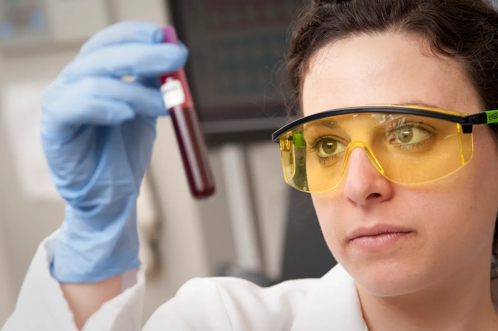 5. Liquid Biopsies: Detecting Cancer from a Simple Blood Draw (Checking Blood Sample, CC BY 2.0)