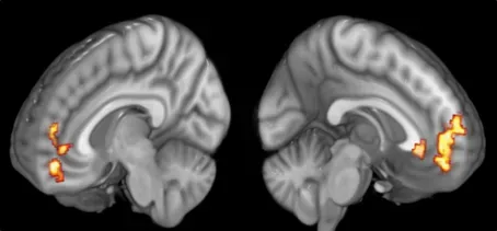 From Ancient Wisdom to Modern Neuroscience (Image Credits: Wikimedia)